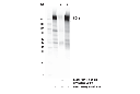 CD45 (D3F8Q) Rabbit mAb