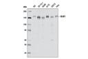 ULK1 (D8H5) Rabbit mAb