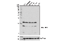 ASC/TMS1 (E1E3I) Rabbit mAb