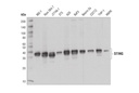 STING (D1V5L) Rabbit mAb (Rodent Preferred)
