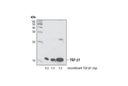 TGF-β (56E4) Rabbit mAb