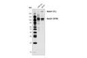 Notch1 (D6F11) XP Rabbit mAb