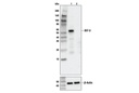 IRF-3 (D6I4C) XP Rabbit mAb