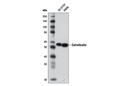 Calreticulin (D3E6) XP Rabbit mAb