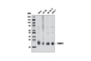 TIMP1 (D10E6) Rabbit mAb