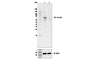 NF-κB p65 (C22B4) Rabbit mAb
