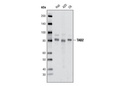 TAB2 (C88H10) Rabbit mAb