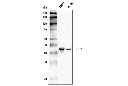 IDH2 (D8E3B) Rabbit mAb