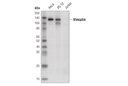 Vinculin (E1E9V) XP Rabbit mAb (HRP Conjugate)