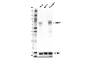 CaMKK2 (D8D4D) Rabbit mAb
