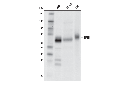 TFEB (D4L2P) Rabbit mAb