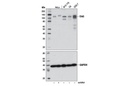 Erk5 (D3I5V) Rabbit mAb