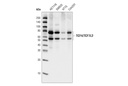 TCF4/TCF7L2 (C48H11) Rabbit mAb