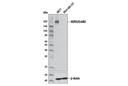 HER3/ErbB3 (D22C5) XP Rabbit mAb