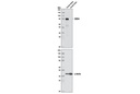 DDX4 (D10C5) Rabbit mAb