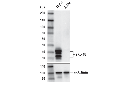 YKL-40 (E2L1M) Rabbit mAb