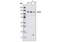 SirT1 (C14H4) Rabbit mAb