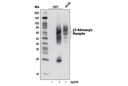 β2-Adrenergic Receptor (D6H2) Rabbit mAb