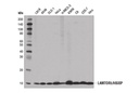 LAMTOR5/HBXIP (D4V4S) Rabbit mAb