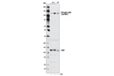 Phospho-Jak2 (Tyr1007) (D15E2) Rabbit mAb