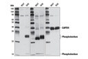 Phospho-Phospholamban (Ser16/Thr17) Antibody