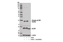 Phospho-4E-BP1 (Ser65) (D9G1Q) Rabbit mAb