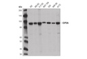 CIP2A (D1M3H) Rabbit mAb