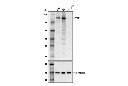TET2 (D6C7K) Rabbit mAb (Mouse Specific)