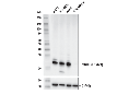 MGMT (E6M7V) Rabbit mAb