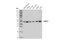 SHMT1 (D3B3J) Rabbit mAb