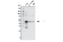 BCKDH-E1α (E4T3D) Rabbit mAb