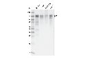 PHF8 (E9R4F) Rabbit mAb