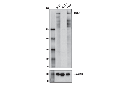 MLL3 (D1S1V) Rabbit mAb