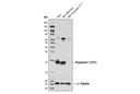 Presenilin 1 (D39D1) Rabbit mAb