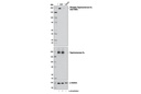 Phospho-Topoisomerase IIα (Ser1469) (D4F5) Rabbit mAb