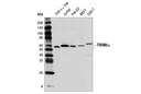 TRIM5α (D6Z8L) Rabbit mAb