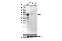 CD39/NTPDase 1 (E2X6B) XPRabbit mAb (Mouse Specific)