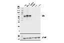 CD5 (E8X3S) XP Rabbit mAb
