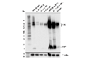 APP (E4H1U) Rabbit mAb