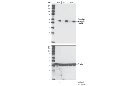 Phospho-Vimentin (Ser56) Antibody