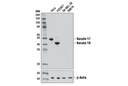 MTMR3 Antibody