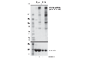 Phospho-CASC5 (Thr943/Thr1155) (D8D4N) Rabbit mAb