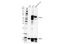 Perforin (E9F7N) Rabbit mAb