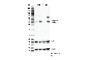 Phospho-LAT (Tyr255) (E3K6B) Rabbit mAb
