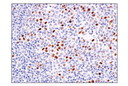 BCL6 (E5I8I) Rabbit mAb