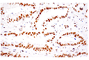 SETD2 (E4W8Q) Rabbit mAb (IHC Formulated)
