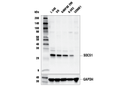 SOCS1 (E4K7Q) Rabbit mAb